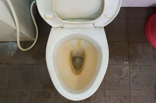 How to Remove Yellow Stains from Toilet Bowl? (Causes & Prevention)