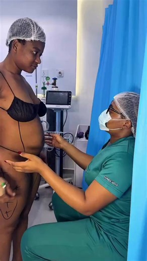 I’m quoting this video of Phyna (BBNaija) undergoing a 360 liposuction because while the "reveal" often looks perfect on camera, the clinical reality behind the scenes is much more intense.A 360 liposuction isn't just a simple fat removal; it involves aggressive contouring of the entire midsection - the abdomen, the waist, and the back. It is a major surgical procedure that places a massive amount of stress on the body’s circulatory and fluid systems.It is important to understand that liposuctio