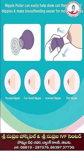 What is an Inverted Nipple? Causes & Treatment | Can Inverted Nipples Affect Breastfeeding ?