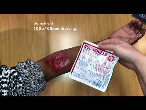 How to apply a Burnshield dressing