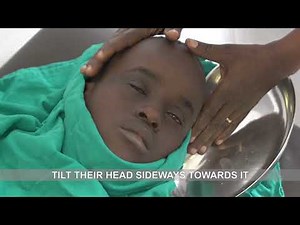How to irrigate a child's eye after chemical injury