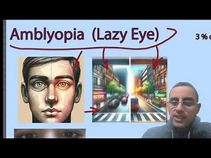 Lazy Eye (Amblyopia) - Causes and Treatment in kids and adults!