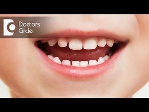 Why are primary or milk teeth important? - Dr. Naganna P M