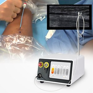 [Hot Item] Evlt 980 1470 Laser Endovascular Laser Varicose Vein Pain Therapy Medical Grade
