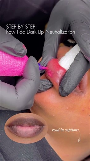 Dark Lip Neutralization Step by Step 💋