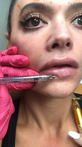 1.1K views · 19 reactions | Another AAFE OMG Super Wowza Lips get...