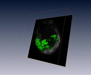 File:Rac1-Dependent-Collective-Cell-Migration-Is-Required-for-Specification-of-the-Anterior-Posterior-pbio.1000442.s024.ogv - Wikimedia Commons