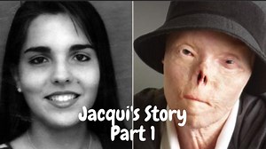 The video provides a chilling account of a drunk driving accident that irreversibly robbed Jacqui Saburido of her physical appearance, the functioning of her hands, and her independence. Reggie Stephey, the driver who collided with Jacqueline Saburido, was merely 18 at the time of the incident in 1999. He had been consuming alcohol at a party in Austin, Texas and was on his way home when his SUV crashed into the vehicle carrying Saburido and her friends. This horrific incident resulted in a trag