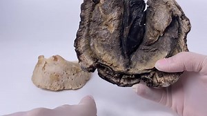 1.1K views · 51 reactions | A quick video on this foot with a hole in...