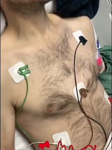 Cheyne-Stokes Respirations: Key Patterns and Insights