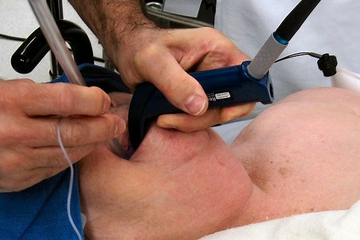 Step-by-step guide to intubation | Emergency Live