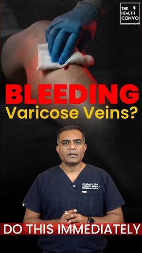 Bleeding Varicose Veins: What To Do Immediately | Emergency First Aid Explained | Dr. Bhavin Ram