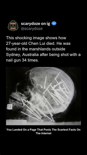 This disturbing image shows the fate of 27-year-old Chen Liu, whose body was discovered in marshlands near Sydney, Australia. He had been sh*t with a nail gun 34 times, the nails driven into his head and torso with mechanical precision. Police said the pattern of wounds suggested he was restrained and conscious when it happened. The marsh kept his body preserved just enough for investigators to uncover the horror. @scarydoze — some tools were never meant to be weapons. | We Will Give You Nightma