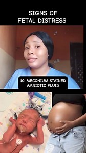 SIGNS OF FETAL DISTRESS YOU MUST KNOW AS A PREGNANT WOMAN. WHEN YOU SEE THESE SIGNS, PLEASE RUN TO THE HOSPITAL #pregnancy #pregnant #pregnancyjourney #pregnancytips #trendingreels #viralvideo #health #Wellness | Midwife Chiamaka
