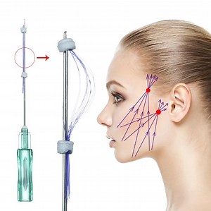 Hilos Facial Tensioning Double Pdo Multi Thread Nose Lifting Korean Thread