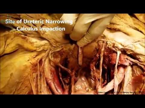 URINARY BLADDER CADAVERIC DISSECTION - Human Anatomy Cadaveric Dissection Videos