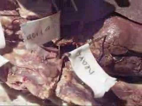 Cat Dissection - Thymus