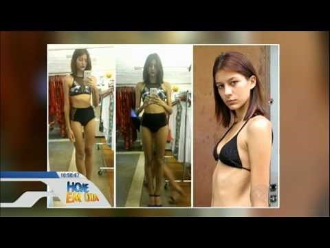 Ex-modelo publica desabafo sobre rotina nas passarelas