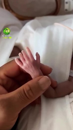Newborn Premature Baby's Heartwarming Handshake