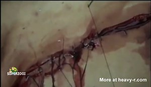 Bleeding for Democracy