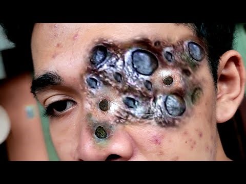 plucking Facial Huge HAIR Remove ASMR
