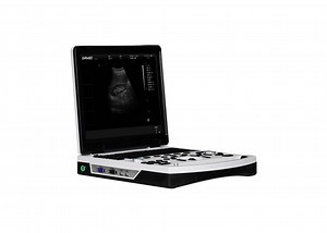 [Hot Item] Dw-690 Portable Dual B&W Ultrasound Diagnostic System Ultrasound Scanner