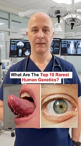 2.5K views · 33 reactions | What are the top 10 rarest human genetics? #health #healthy #healthtips #usa #fyp | kellycruz67 | Facebook