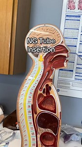 NG tube insertion #medical #backtowork #Medicalsciencses #medicaleducation #icunurse #micropigmentacion #Radiology #molecularbiology #viruses #pharmacy #nerves #laboratory #cellbiology #mitochondria #cardiology #medical_sciences #anatomy #medicine #medicalsciences #biotech #virology #science #microbiology #microbiology_lab #meditacion #pharmacology #Medical_Sciences #MedicalSciences #neurology #medicalstudent | Medical Sciences