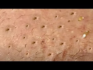 Satisfying Relaxing Best Video with Win Spa #120