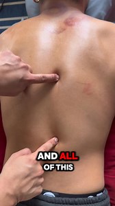 85K views · 226 reactions | Finding tension through the back! #backpain #muscles #massage #tension #painrelief | Greater Therapeutics | Facebook