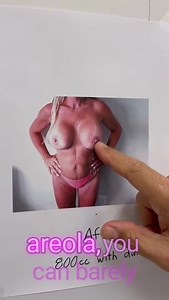 Internal Mesh Bra Breast Aug