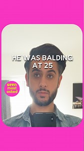1.8K views | How Much Do Hair Transplants Cost? He started losing hair at 25 years old and avoided looking at himself in the mirror. Carlo decided to take back control and get a hair transplant. He answers the most commonly asked questions about getting a hair transplant. The Hair Transplant Specialist | seen.tv | Facebook