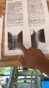 තායිලන්තයේ 🇹🇭 වෙසෙන බෙල්ල දිග කාන්තාවන්… | GUTD Grip