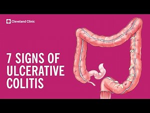 7 Warning Signs of Ulcerative Colitis