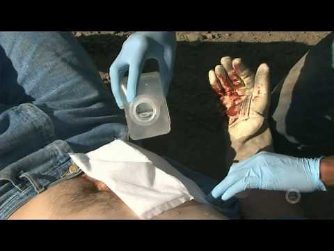 ASHI Basic First Aid - Open Abdominal Wound