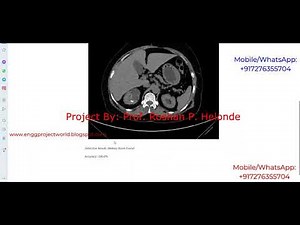 Kidney Stone Detection Using Image Processing Python Project With Source Code Identify Kidney Stone