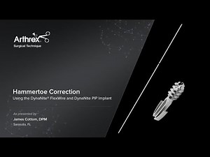 Hammertoe Correction Using DynaNite® FlexWire and DynaNite PIP Implant