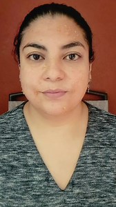 1.6K views · 31 reactions | Mascarilla Casera de Manzana para eliminar Manchas y Arrugas en la piel #mascarillas #skincare #manchasfaciales | Lau Lopez | Facebook