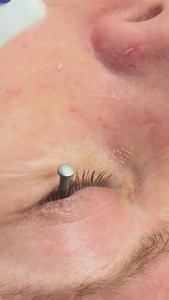 Pulse Light Clinic on Reels