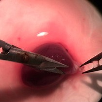 Video: Isolation and Characterization of Primary Rat Valve Interstitial Cells: A New Model to Study Aortic Valve Calcification