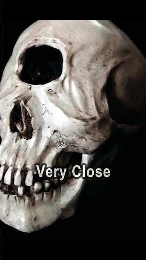 One-Eyed baby born #congenital #cyclops #medical #evolution #survival #life #heredity #dna