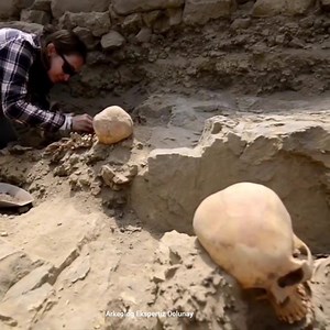 Arkeoloji çalışması ameliyata benzer | Define Arkeoloji ve Tarih Üzerine Herşey