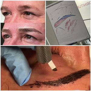 DermaFusion on Reels