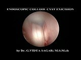 Endoscopic Colloid Cyst Excision • Video • MEDtube.net
