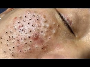 𝙍𝙚𝙡𝙖𝙭𝙞𝙣𝙜 𝙎𝙠𝙞𝙣𝙘𝙖𝙧𝙚 𝙍𝙤𝙪𝙩𝙞𝙣𝙚 𝘾𝙡𝙚𝙖𝙣𝙨𝙞𝙣𝙜 𝙛𝙤𝙧 𝙖 𝙋𝙚𝙖𝙘𝙚𝙛𝙪𝙡 𝙈𝙞𝙣𝙙 #