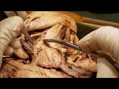 FOUR Anterior Neck Triangles – Boundaries Contents Surgical Anatomy – Sanjoy Sanyal