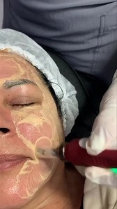 25K views · 12 comments | BB GLOW Efecto Porcelana.... Sesion $1000 pesos | Queen Spa Clinic. | Facebook