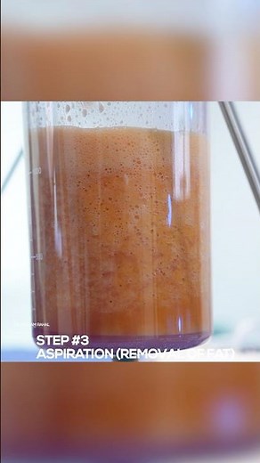 The ULTIMATE Step-by-Step Guide to 360 Lipo & BBL – Transform Your Body!