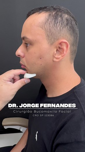 Implantes Faciais: A Singularidade do Paciente