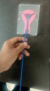 Uteroject HSG device